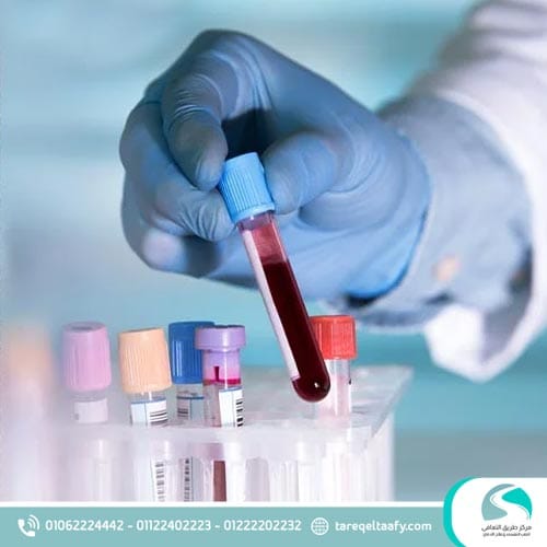 مدة بقاء الكحول في الجسم: الجدول الكامل من مركز طريق التعافي 5 اسم تحليل الكحول في الدم