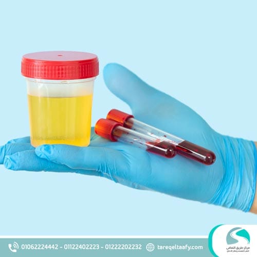 مدة بقاء دواء نالتركسون في البول والدم؟