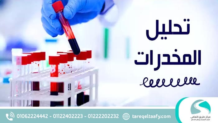 طرق خداع تحليل المخدرات؟ ومدة بقاء كل مخدر